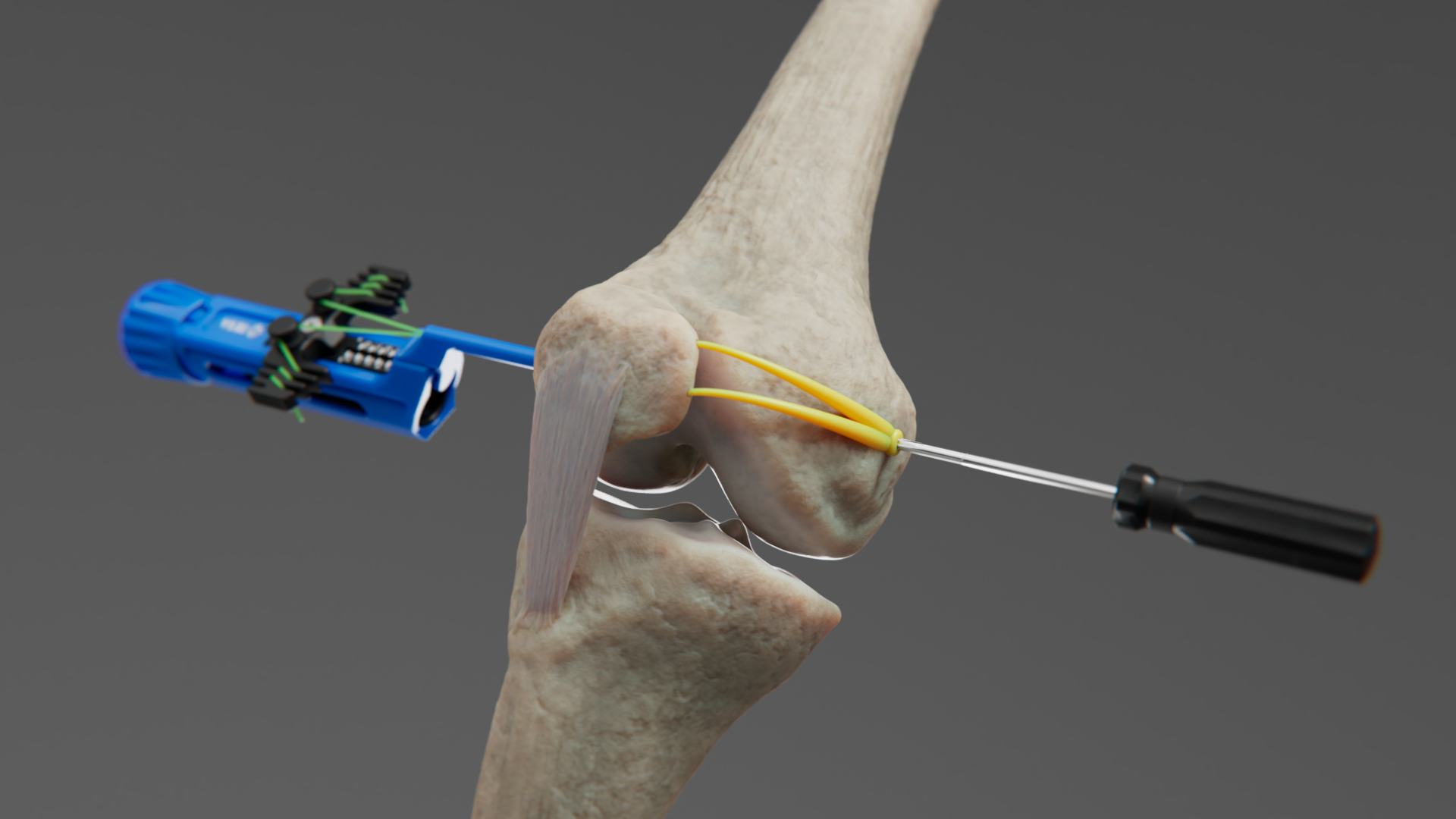 3D render of a surgical device placed into a joint